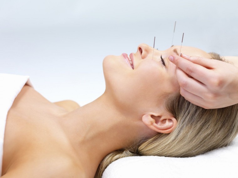 cosmetic acupuncture1